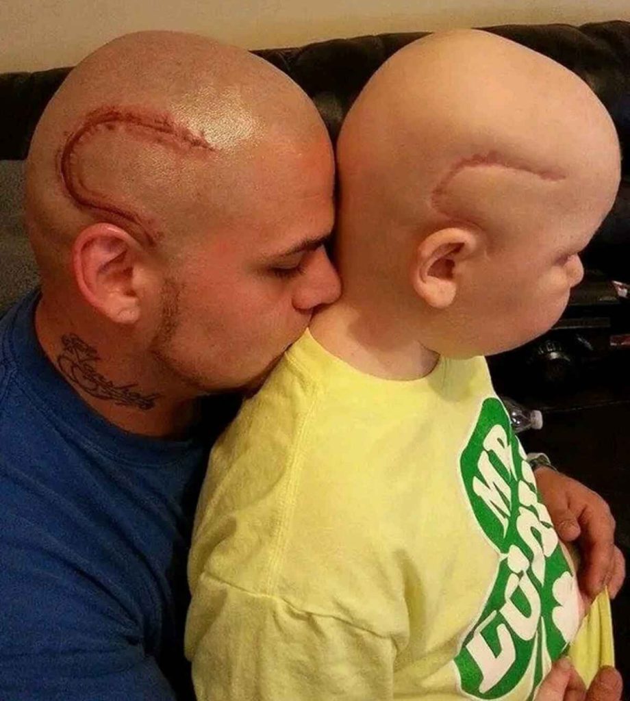 The Father's Hero Scar Tattoo